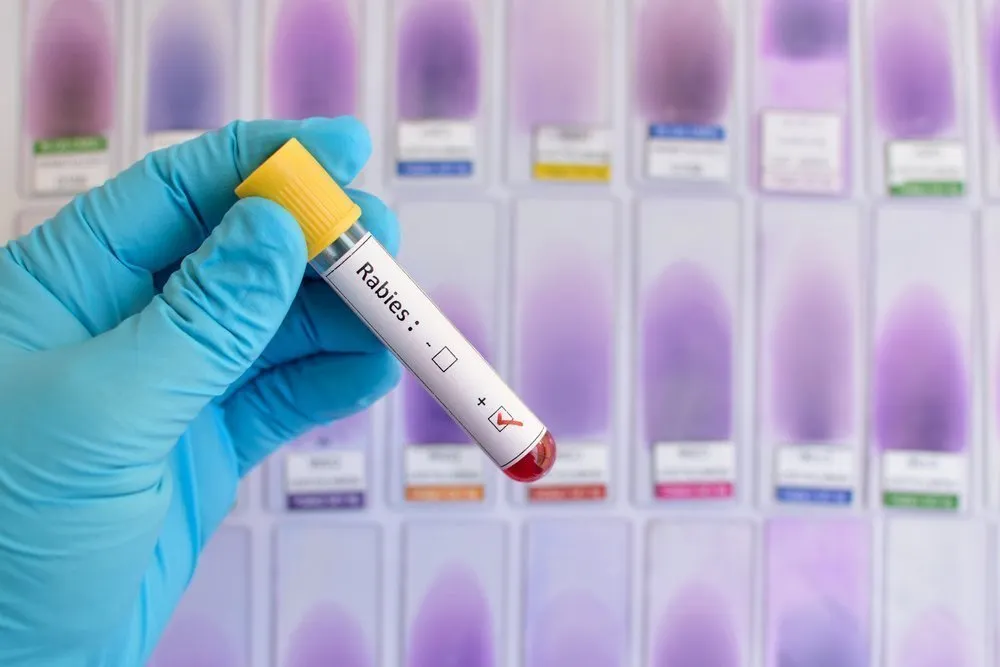 Бешенство у человека