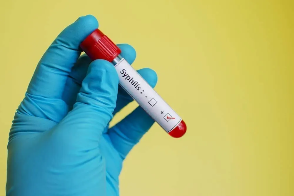 Сифилис: симптомы и лечение
