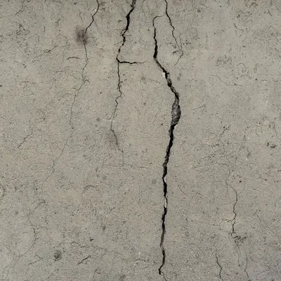 Анальная трещина - причины ректальной боли