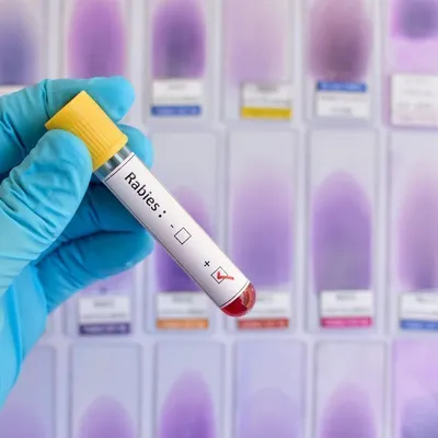 Бешенство у человека