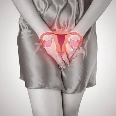 Эндометриоз: симптомы и лечение