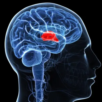 Гиперпролактинемия