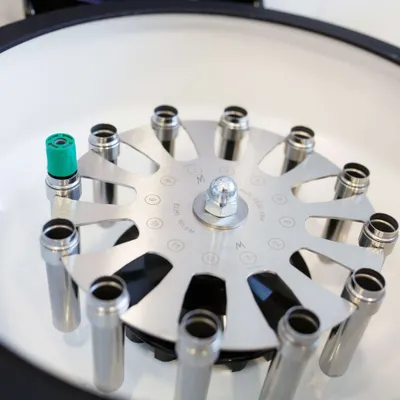 Что такое спермограмма?