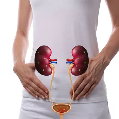 Пиелонефрит: симптомы и лечение