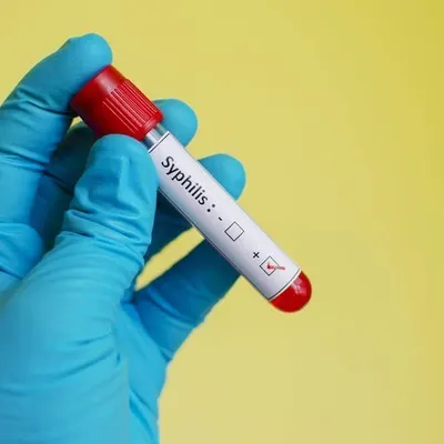 Сифилис: симптомы и лечение